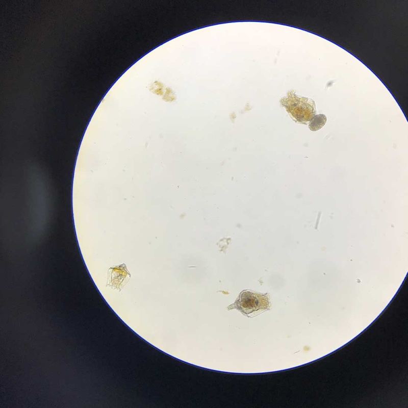 Rotifer Brachionus Calyciflorus Pallas Eggs